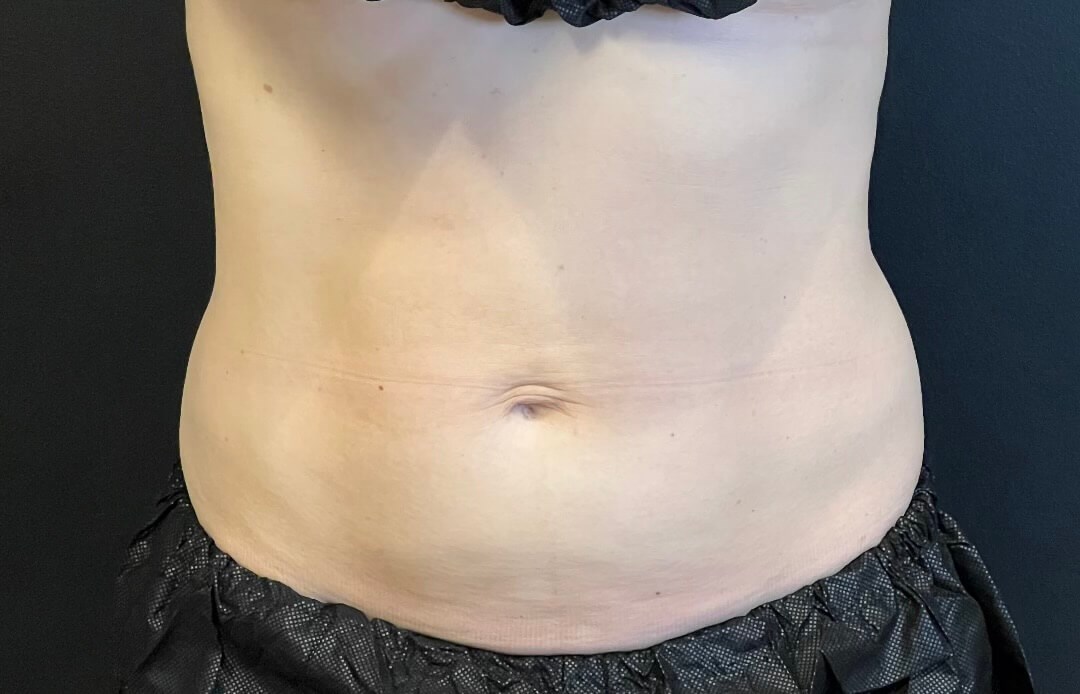 Before Image