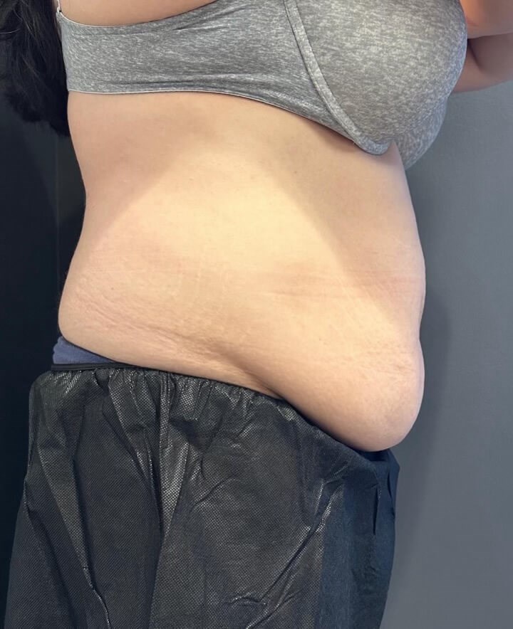 Before Image