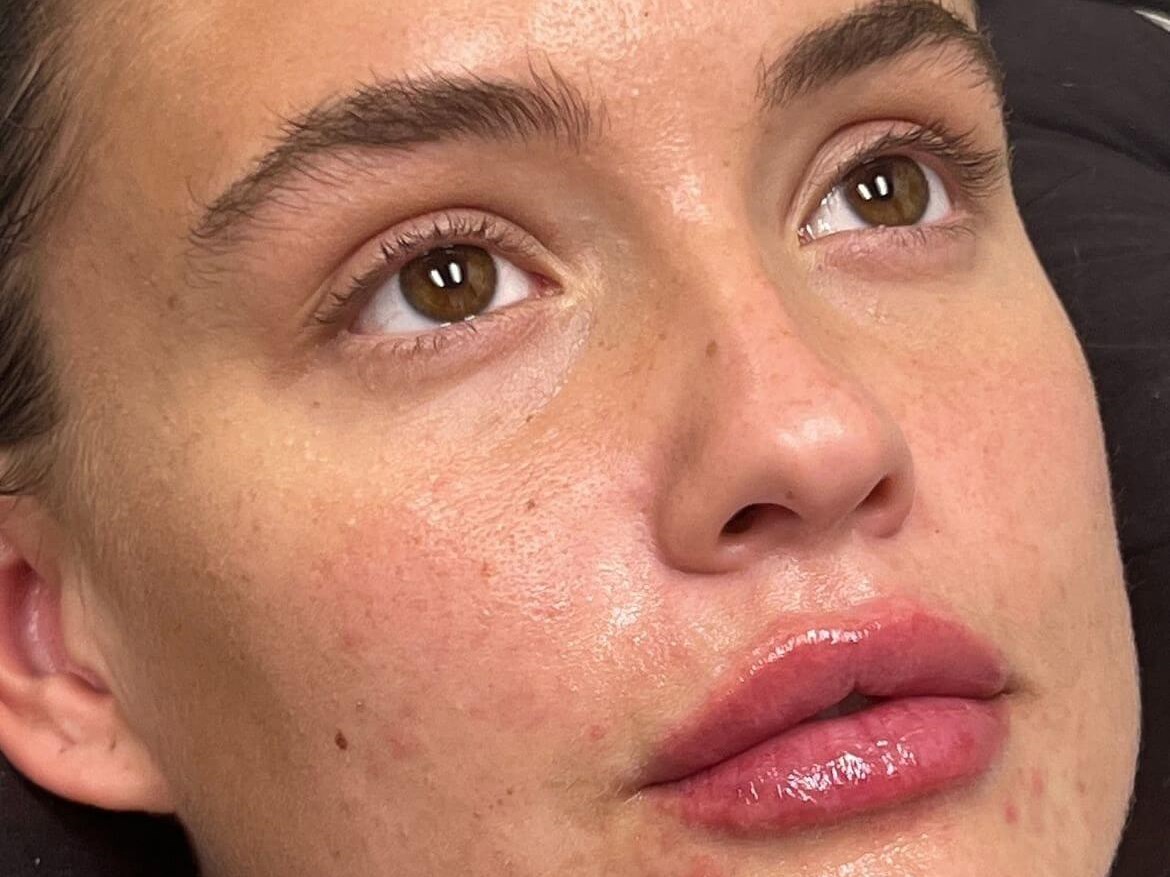 Enhance Your Lips After