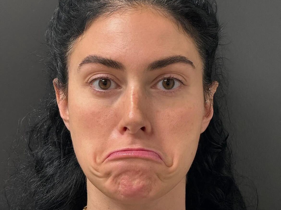 The Magic of Botox Before