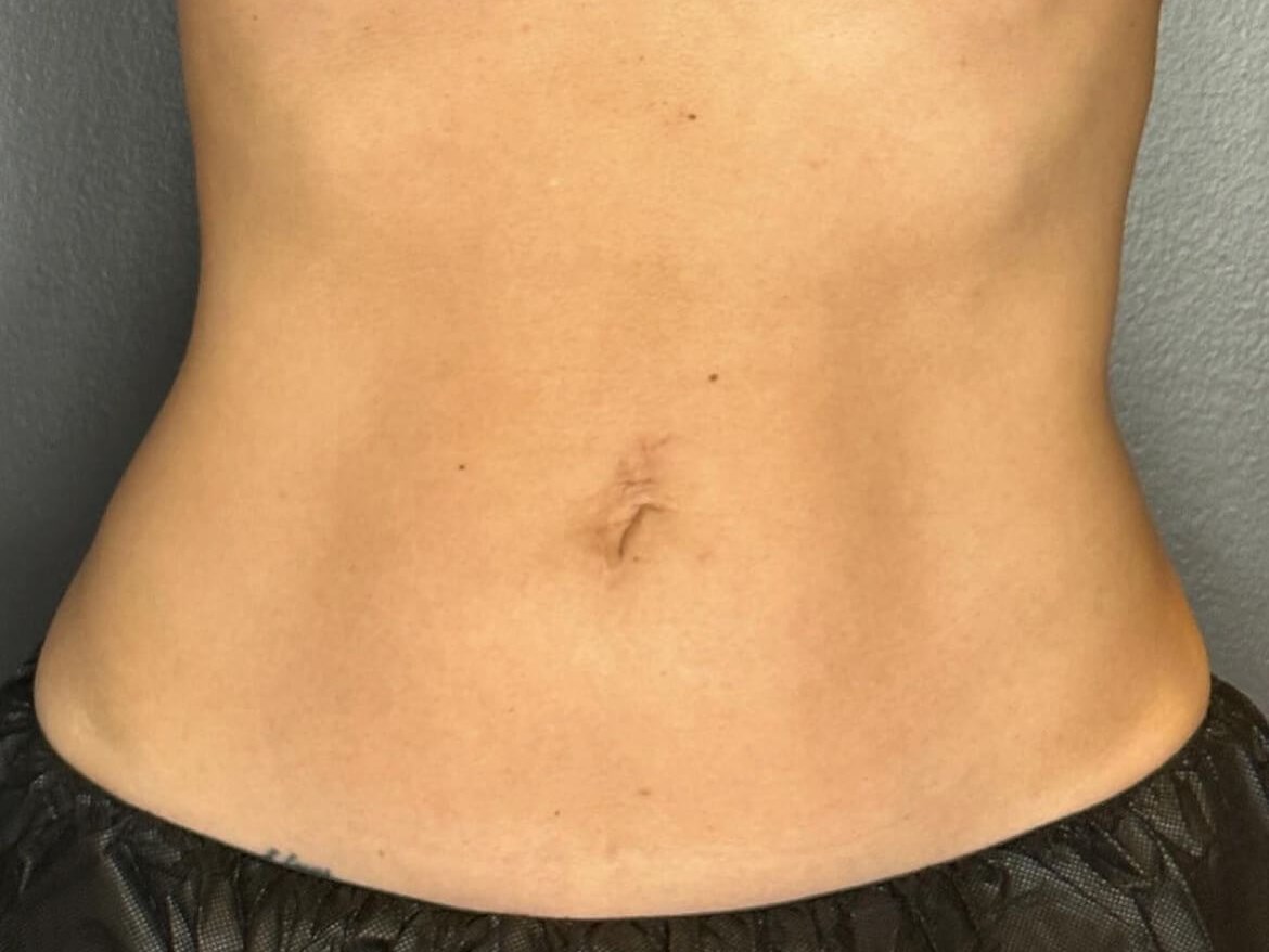 Define and Tone Your Abs After