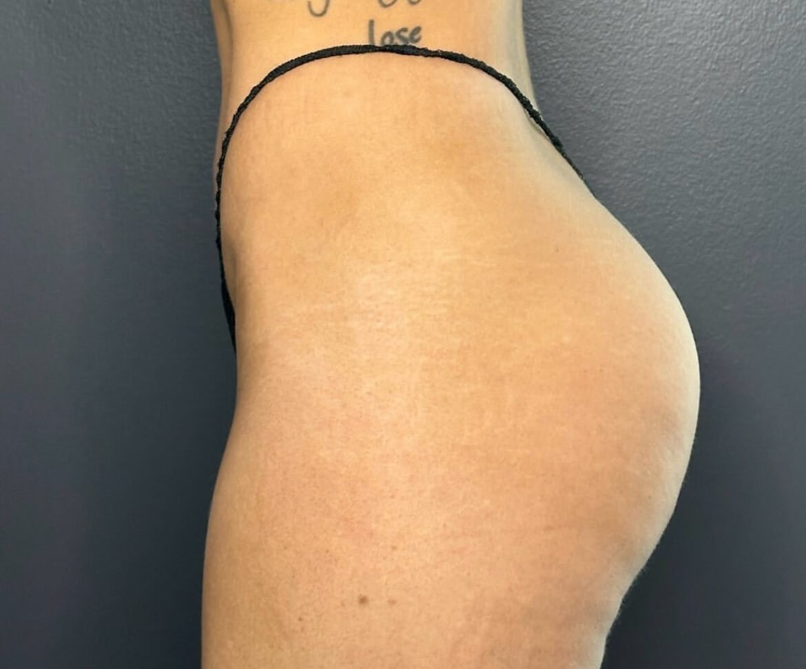 After Image
