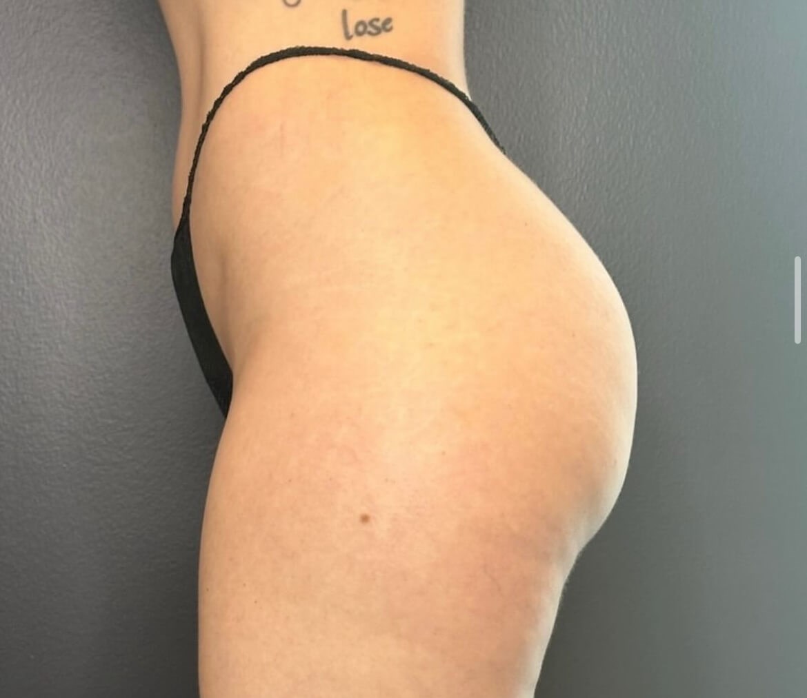 Before Image
