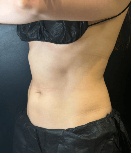 After Image