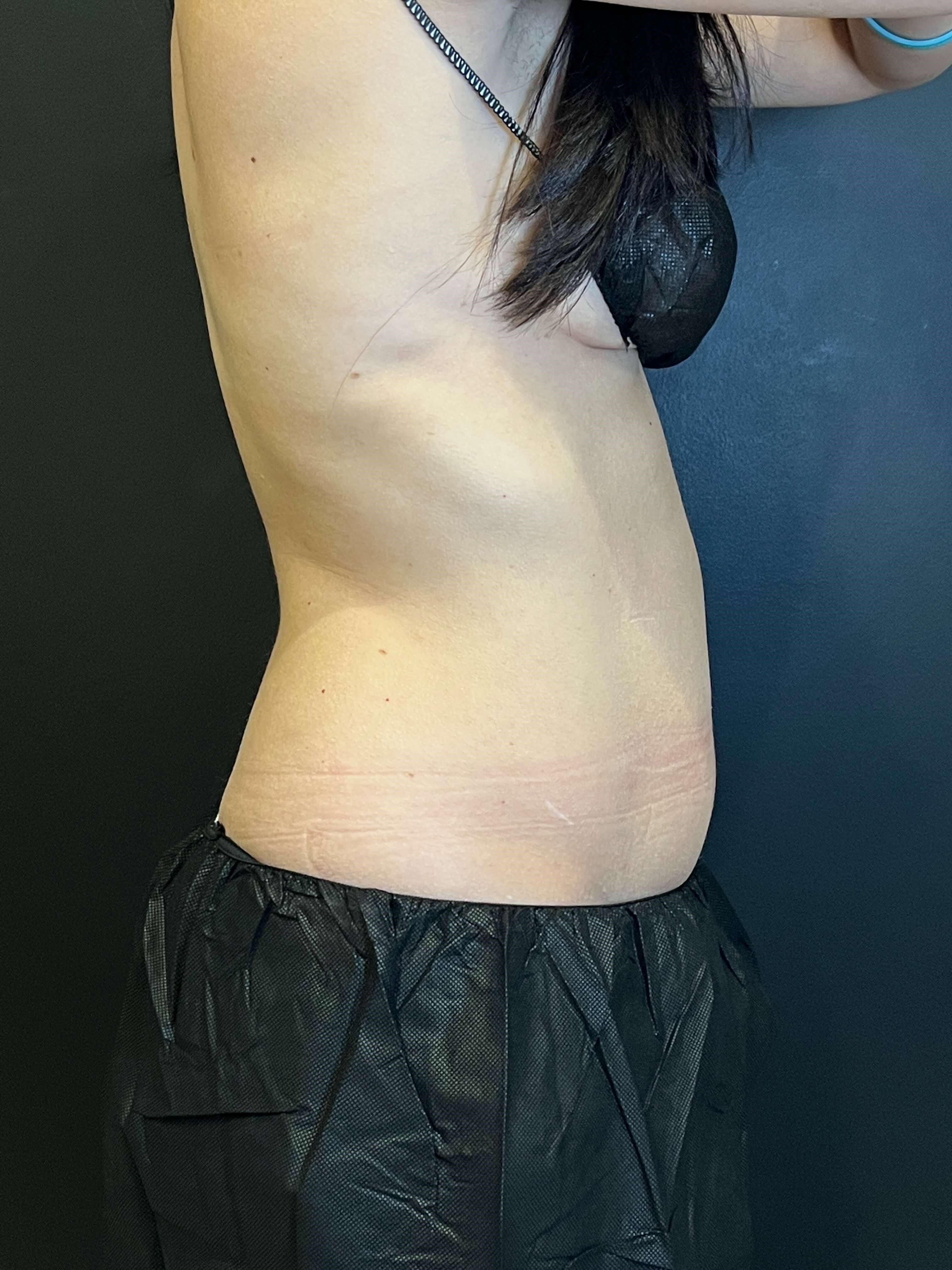 After Image