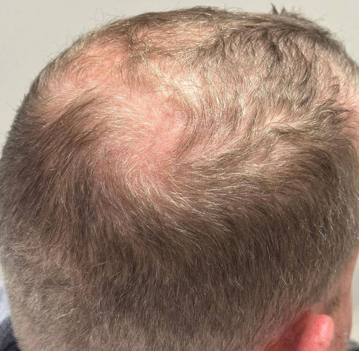 Revitalize Your Hair Before