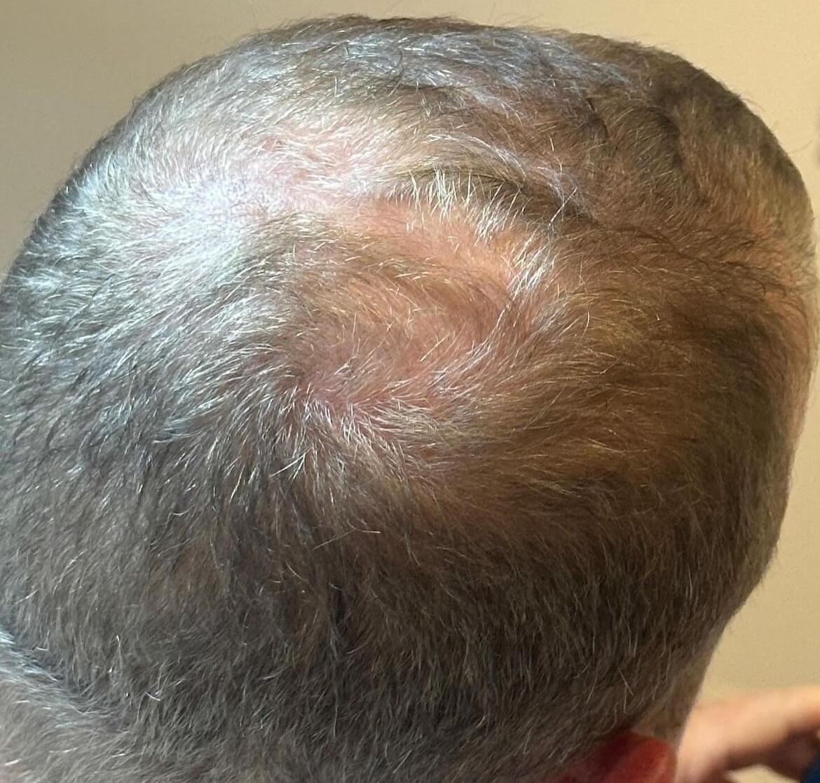 Revitalize Your Hair After
