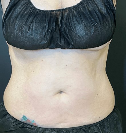 Transform your Bodu Before