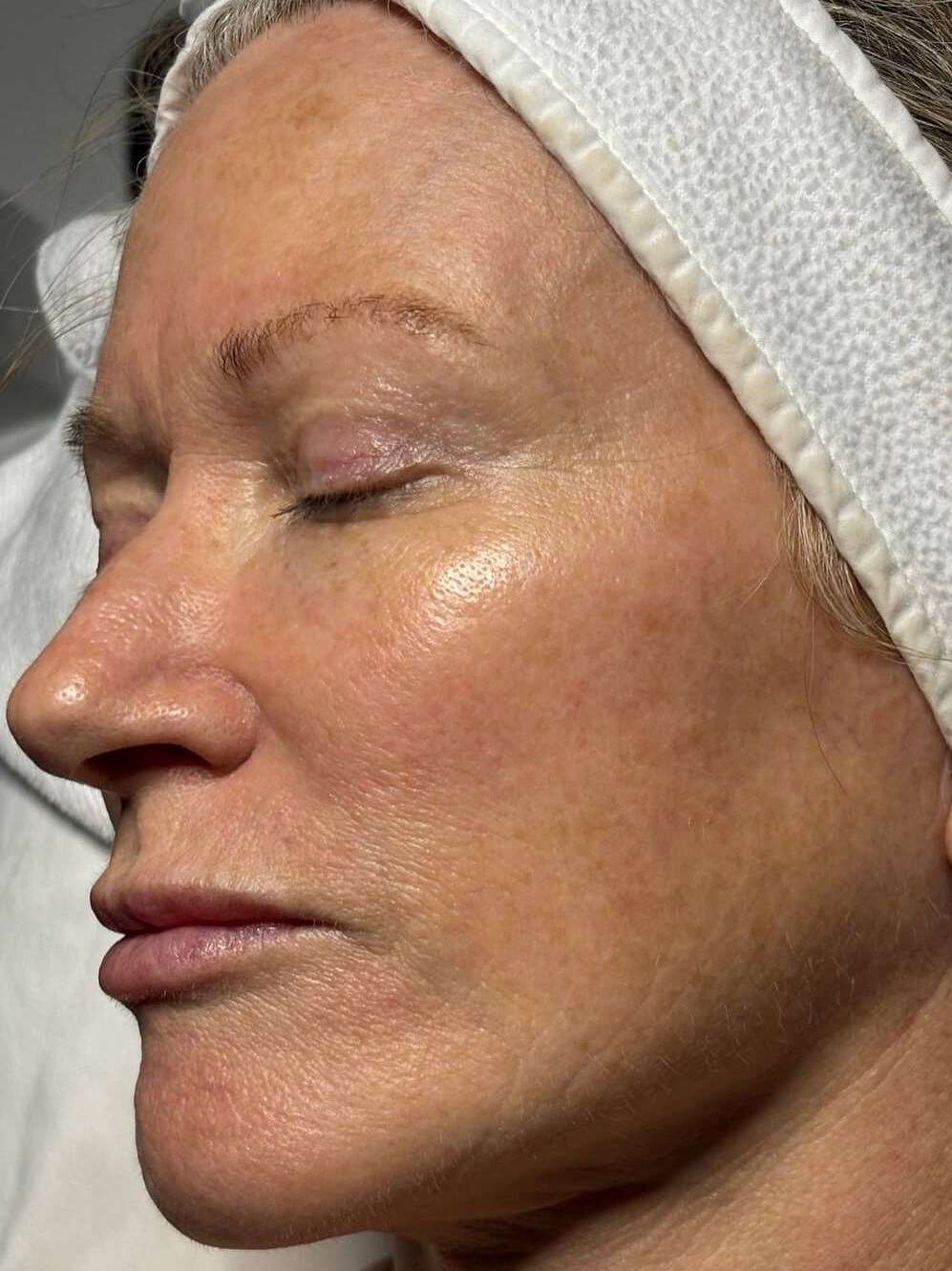Revitalize Your Glow After