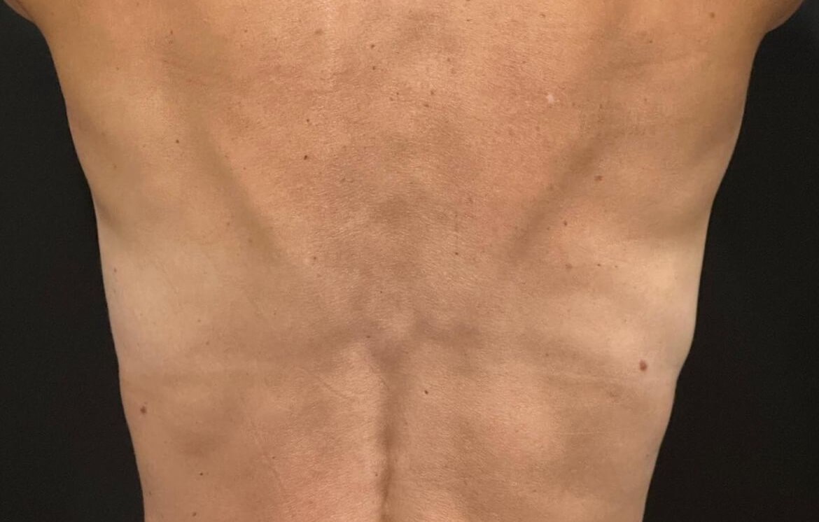 After Image