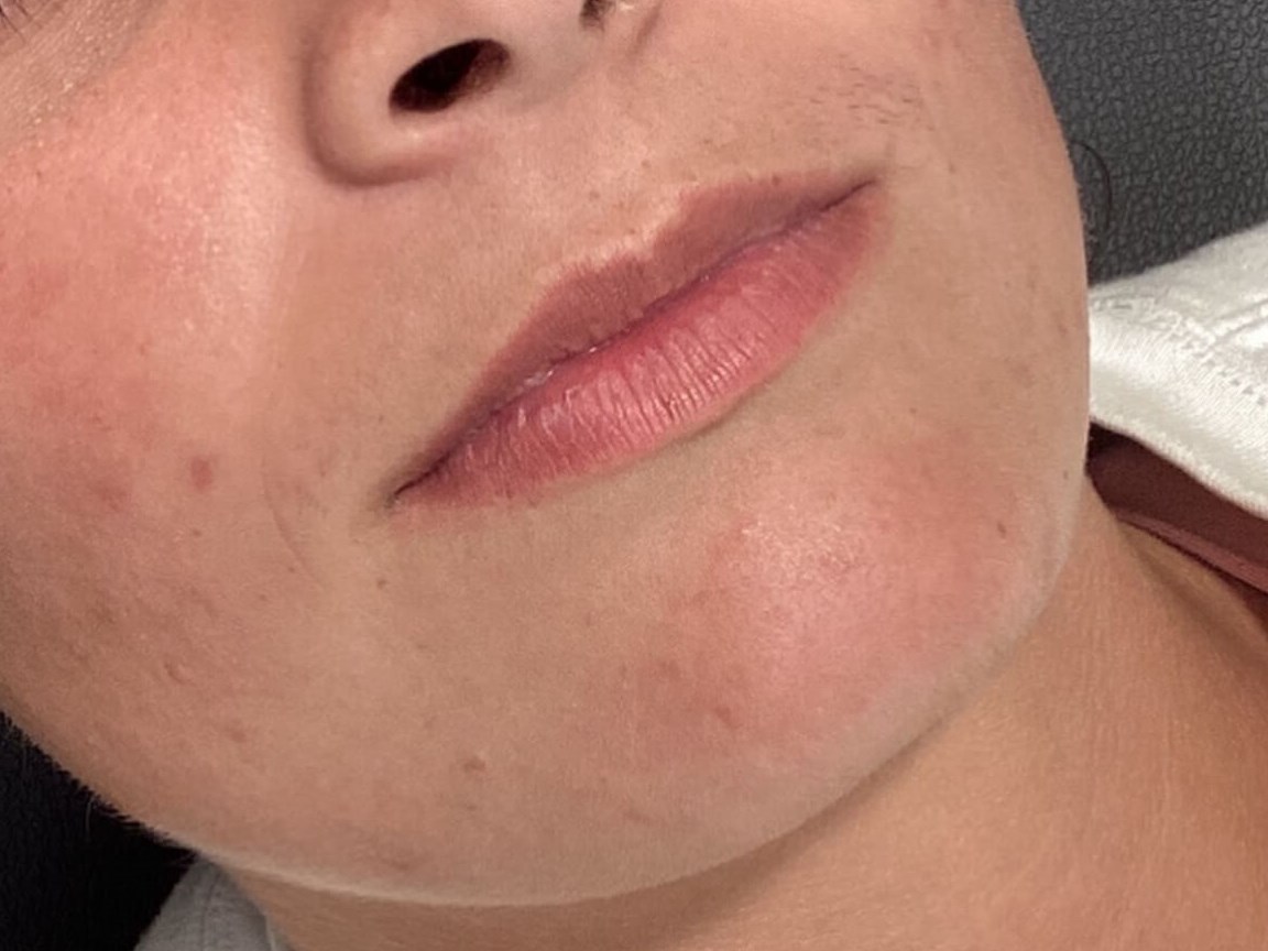 Perfect your Pout Before