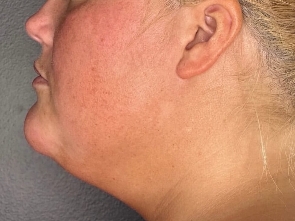 Contour Your Jawline Before