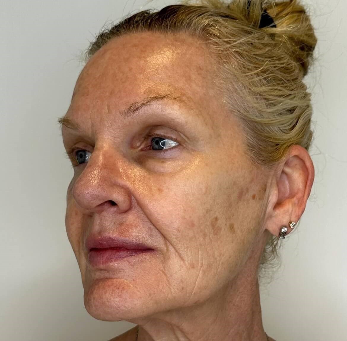 Revitalize your Skin Before