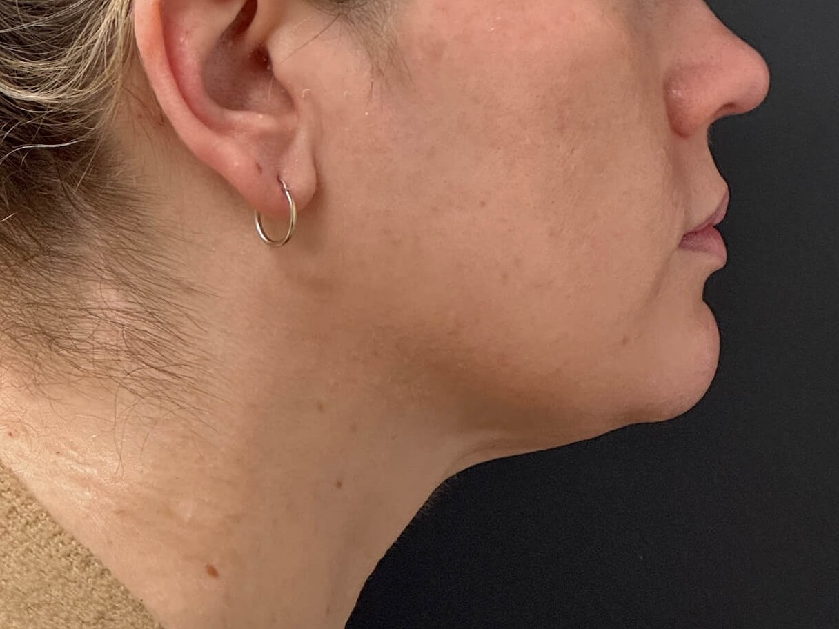 Transform your profile at JEM After