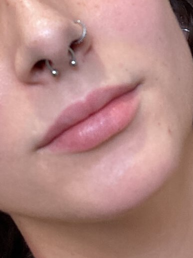Enhacing your lips Before