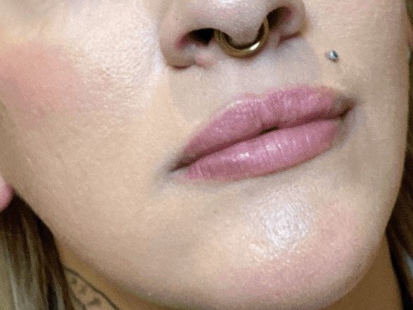 Fuller Lips at JEM Before