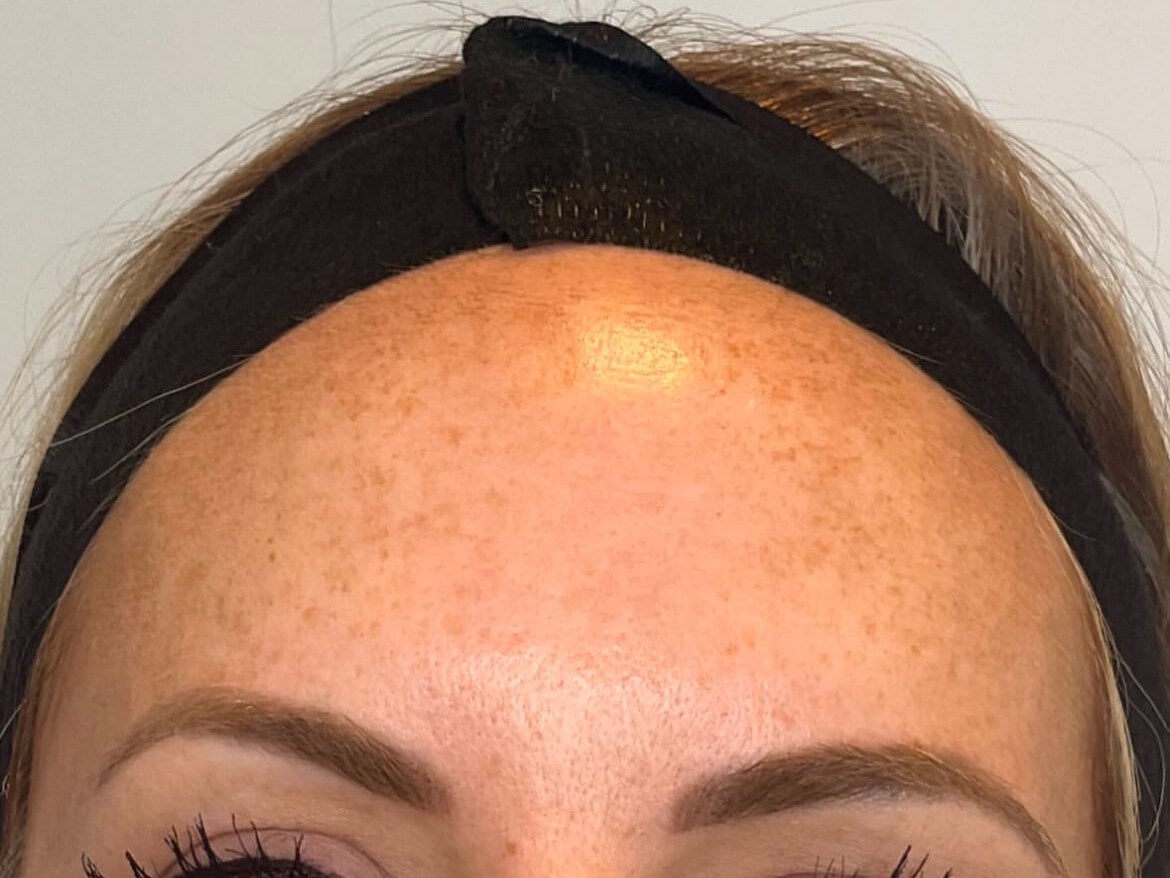 Rejuvenate your skin at JEM Before