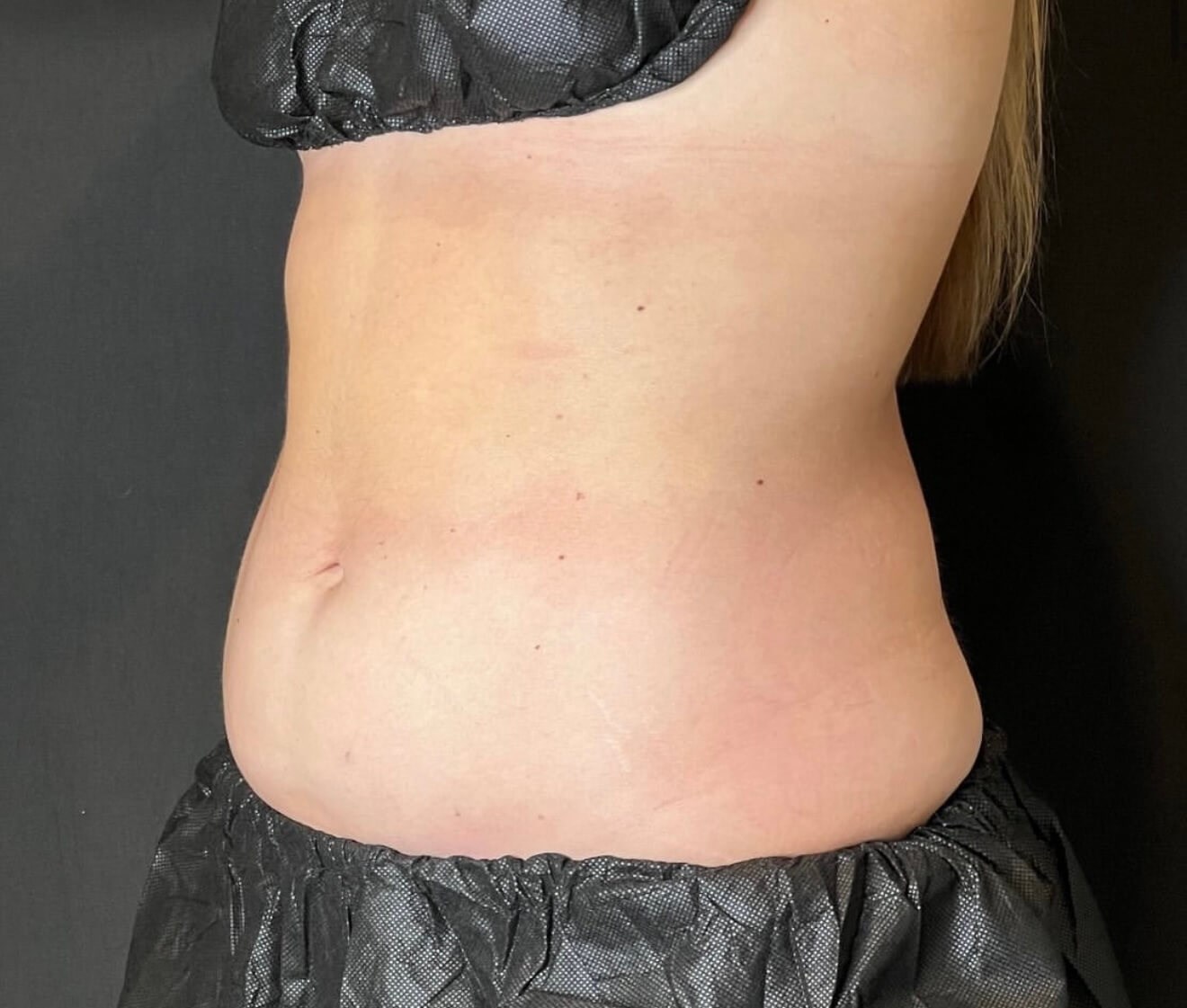 Sculpted Abs Before