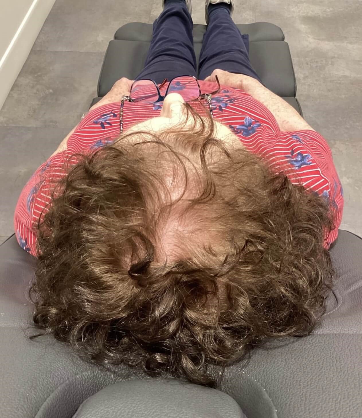 Hair Restoration Reveal Before