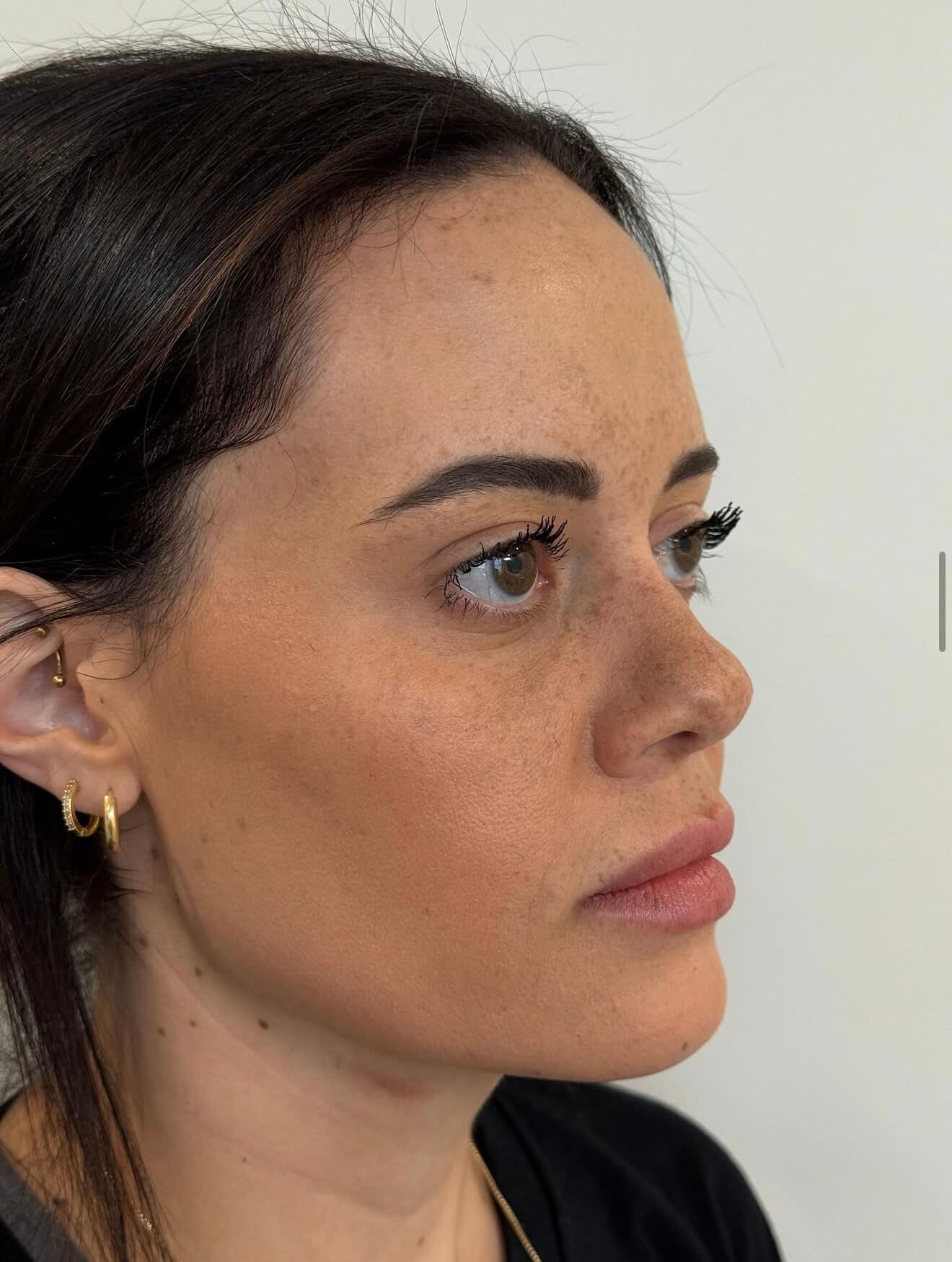 Sculpted Face Before & After After