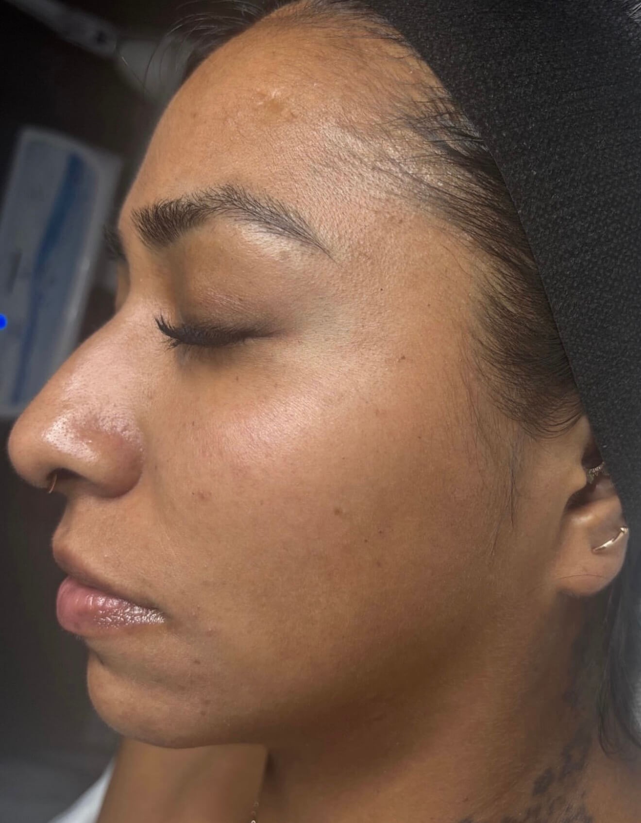 Peel Perfection After