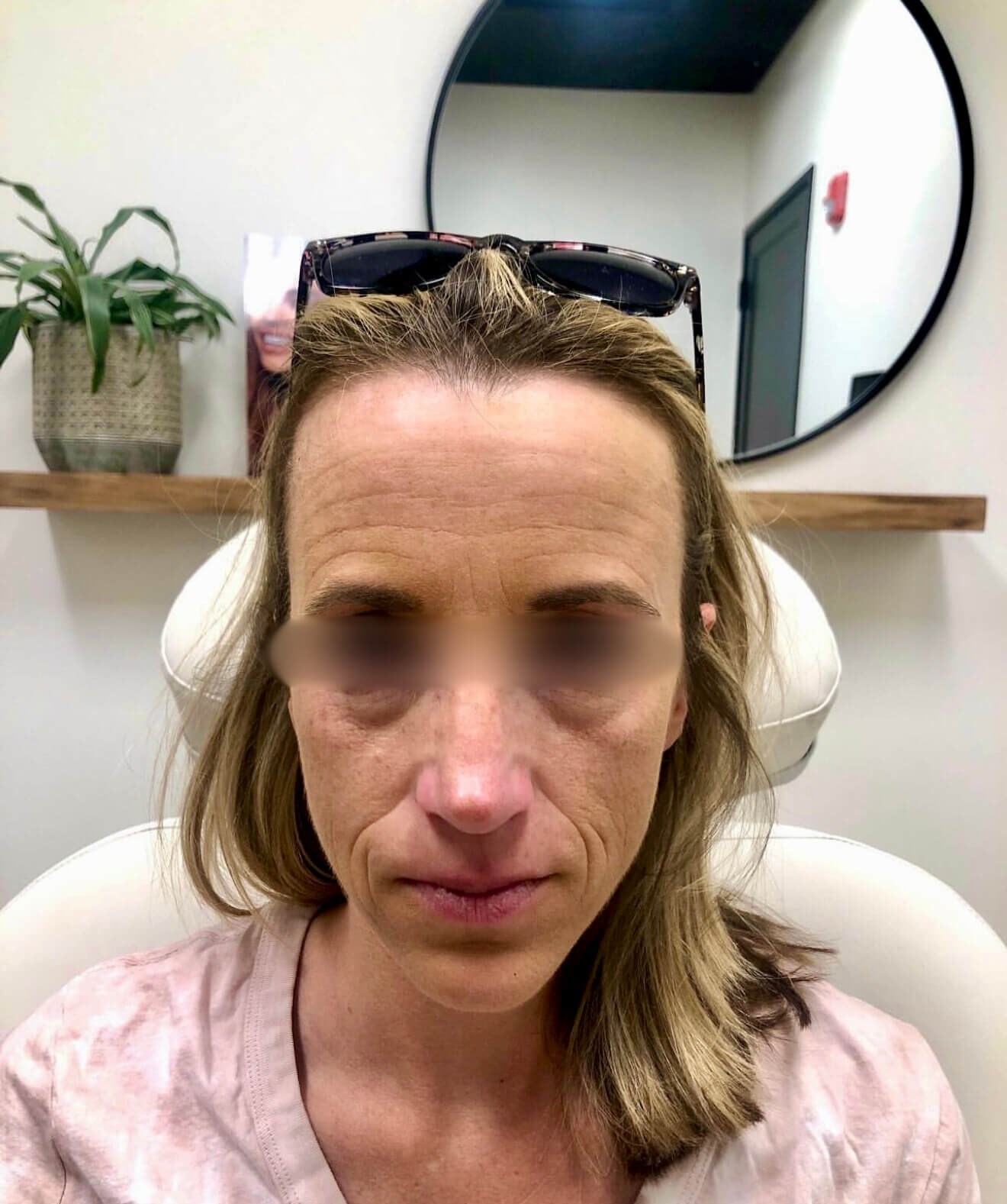 Radiant Results Before
