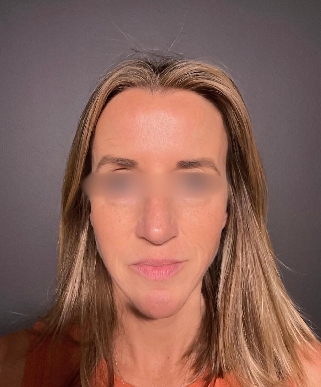 Radiant Results After