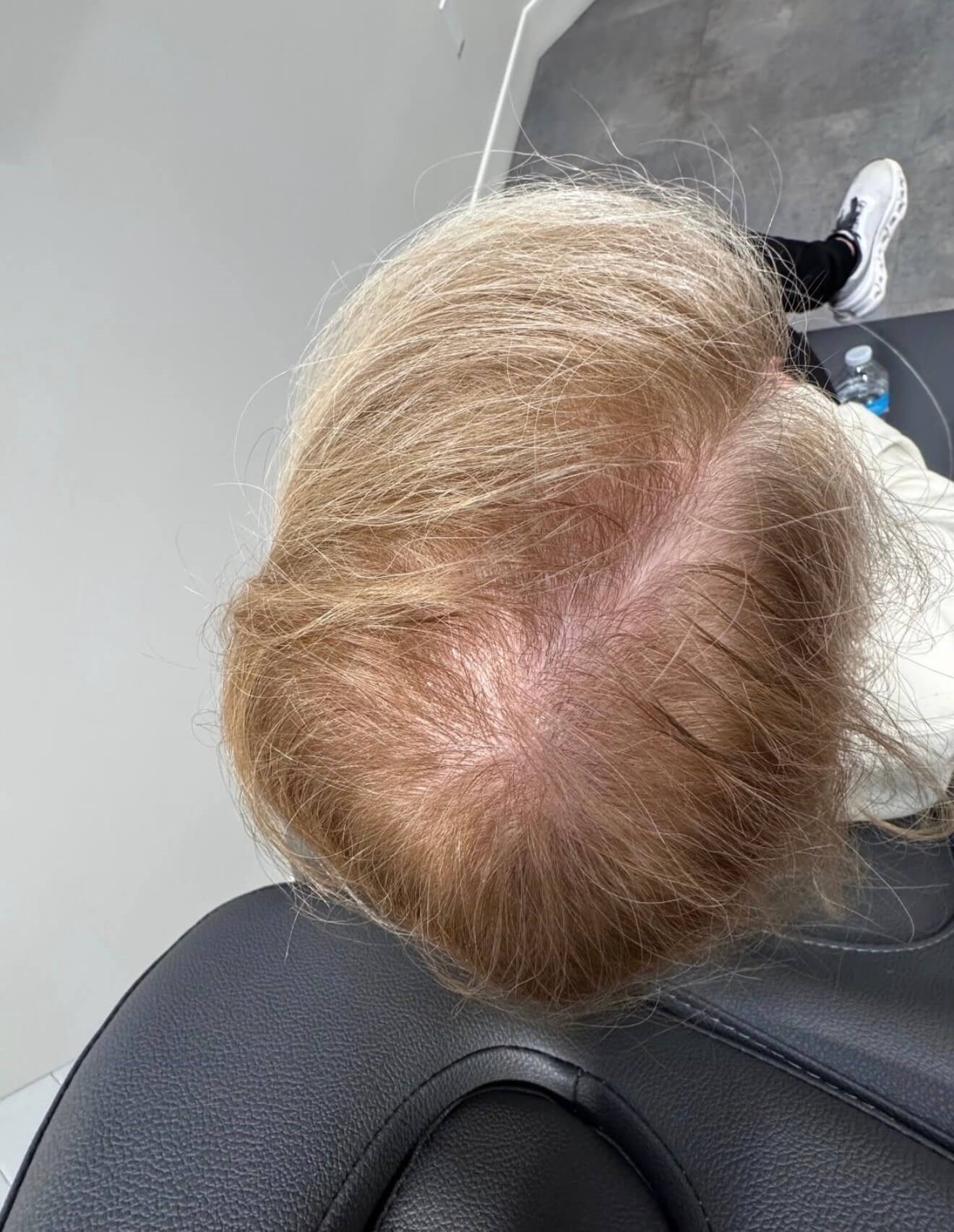 Before Image