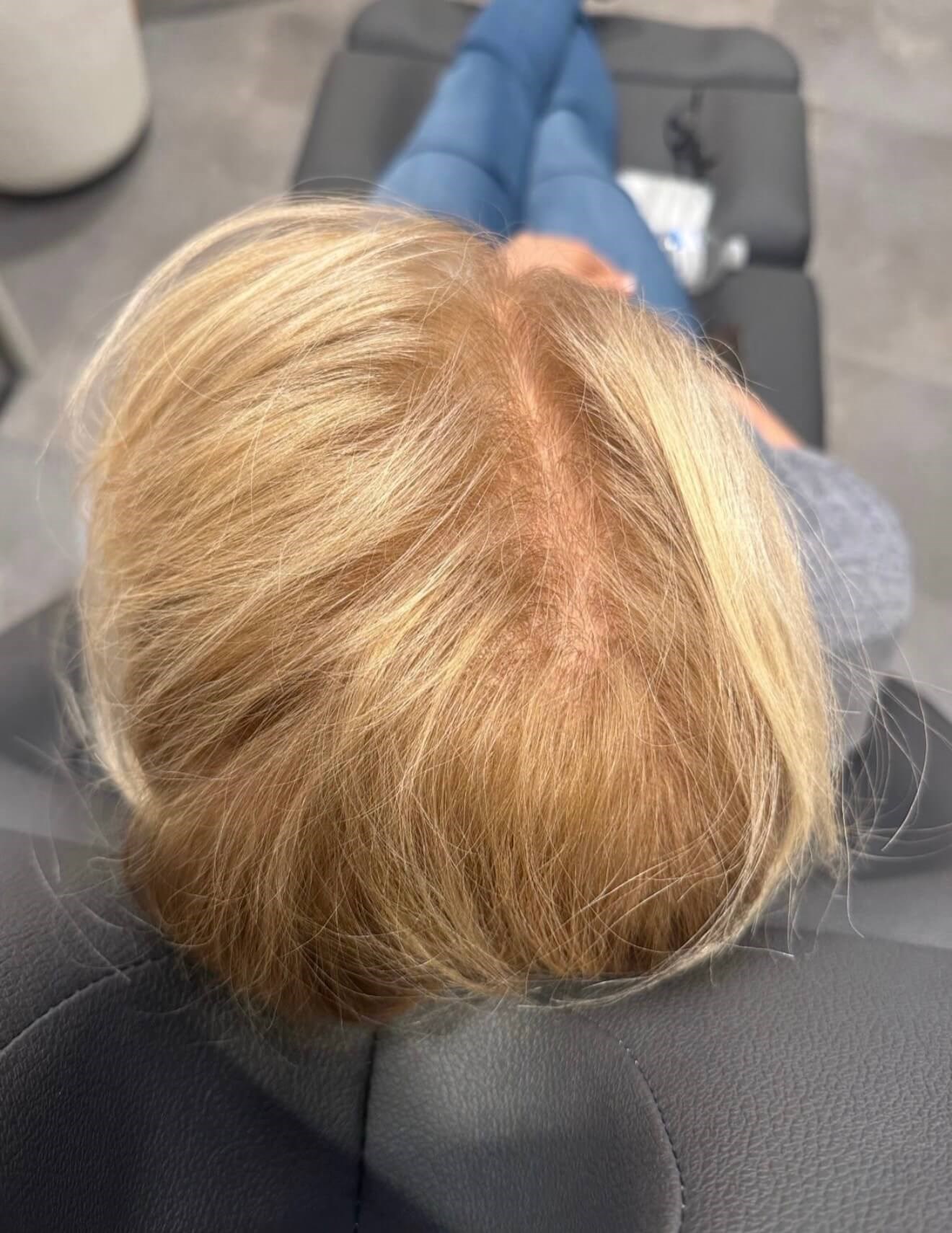 After Image