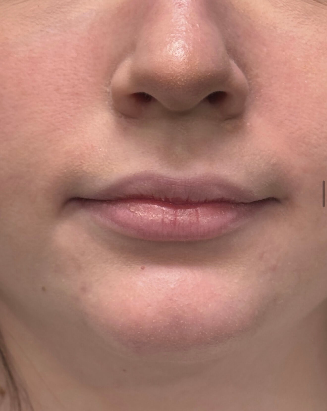 Softly Defined Lips Before