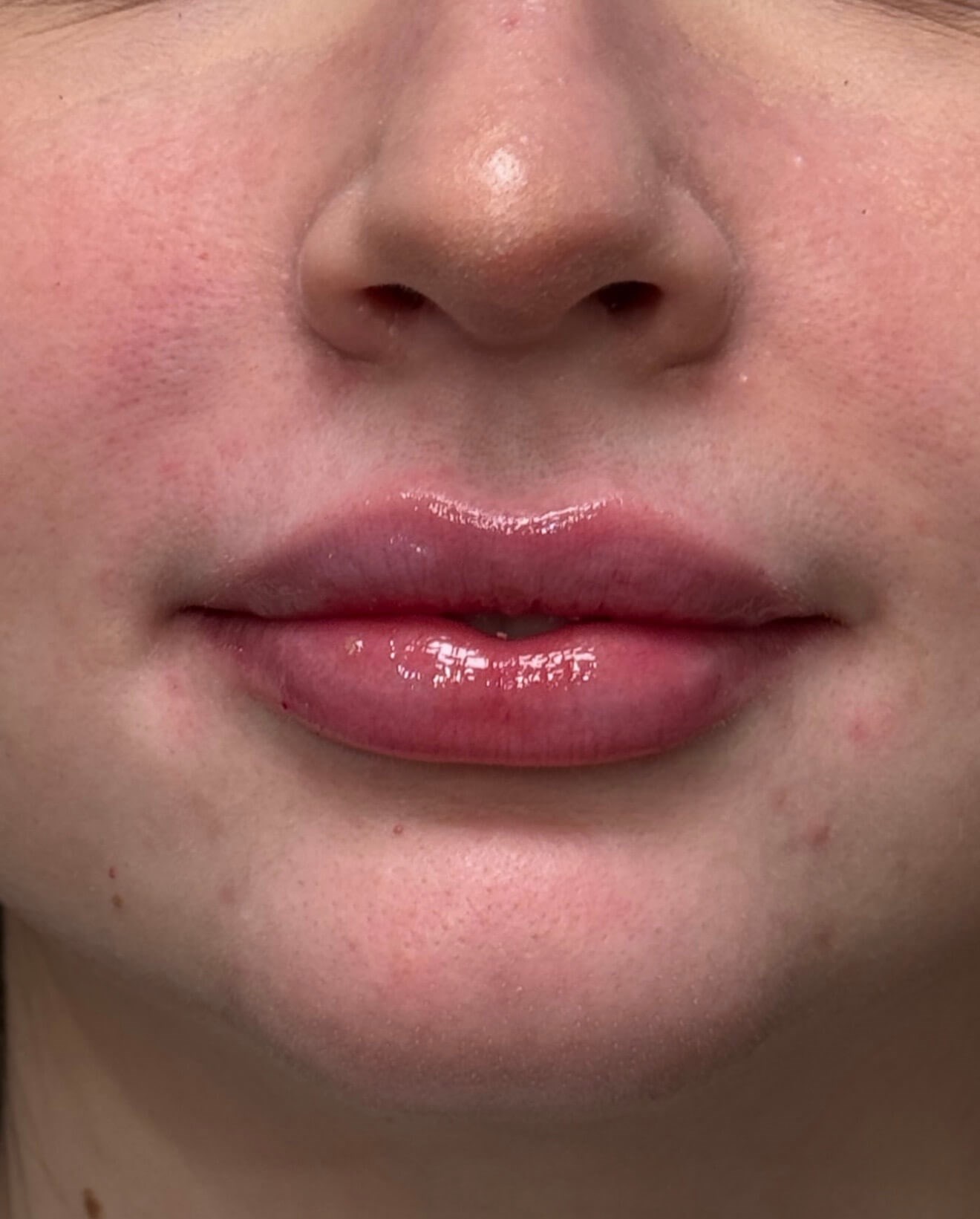 Softly Defined Lips After