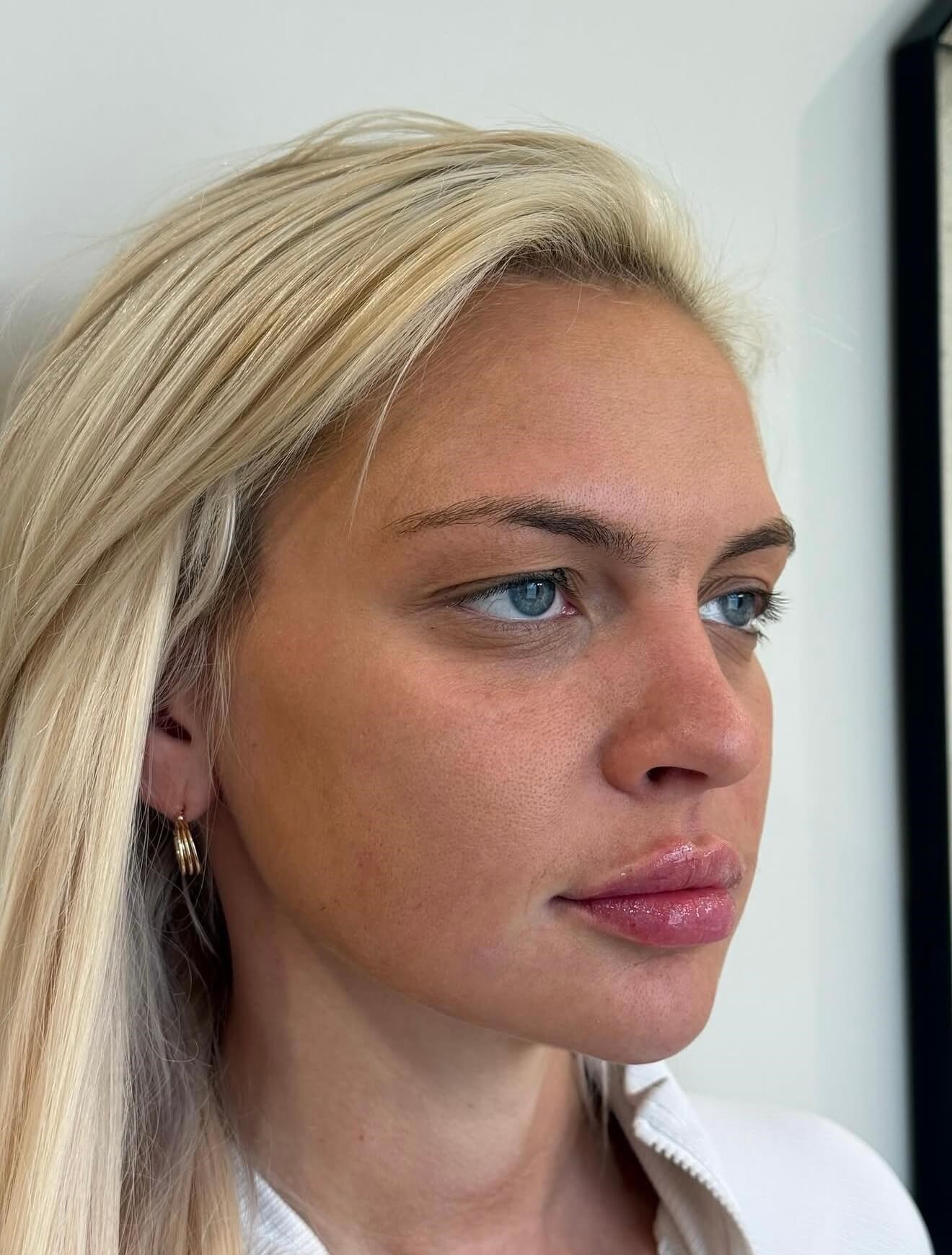 After Image
