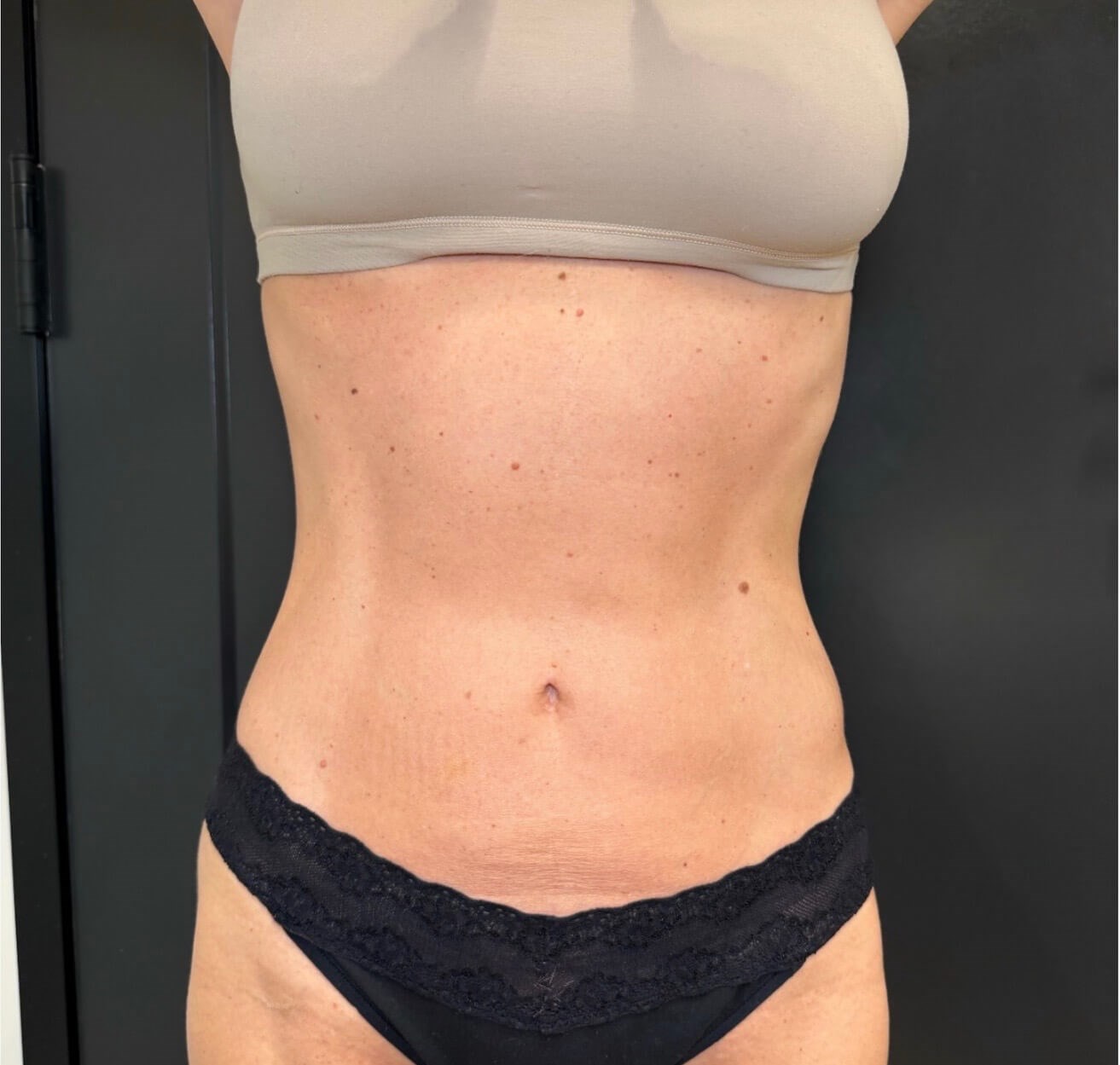 After Image