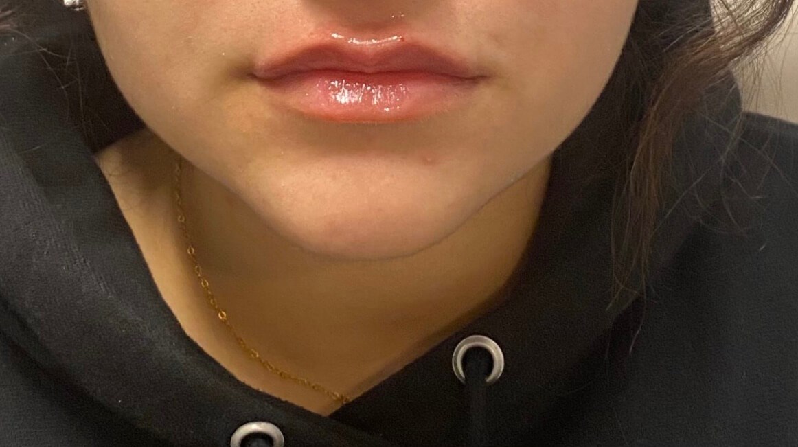 Volbella Lips After
