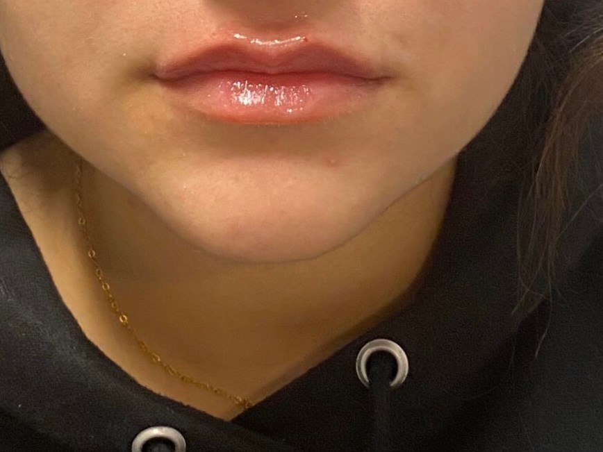 Volbella Lips After