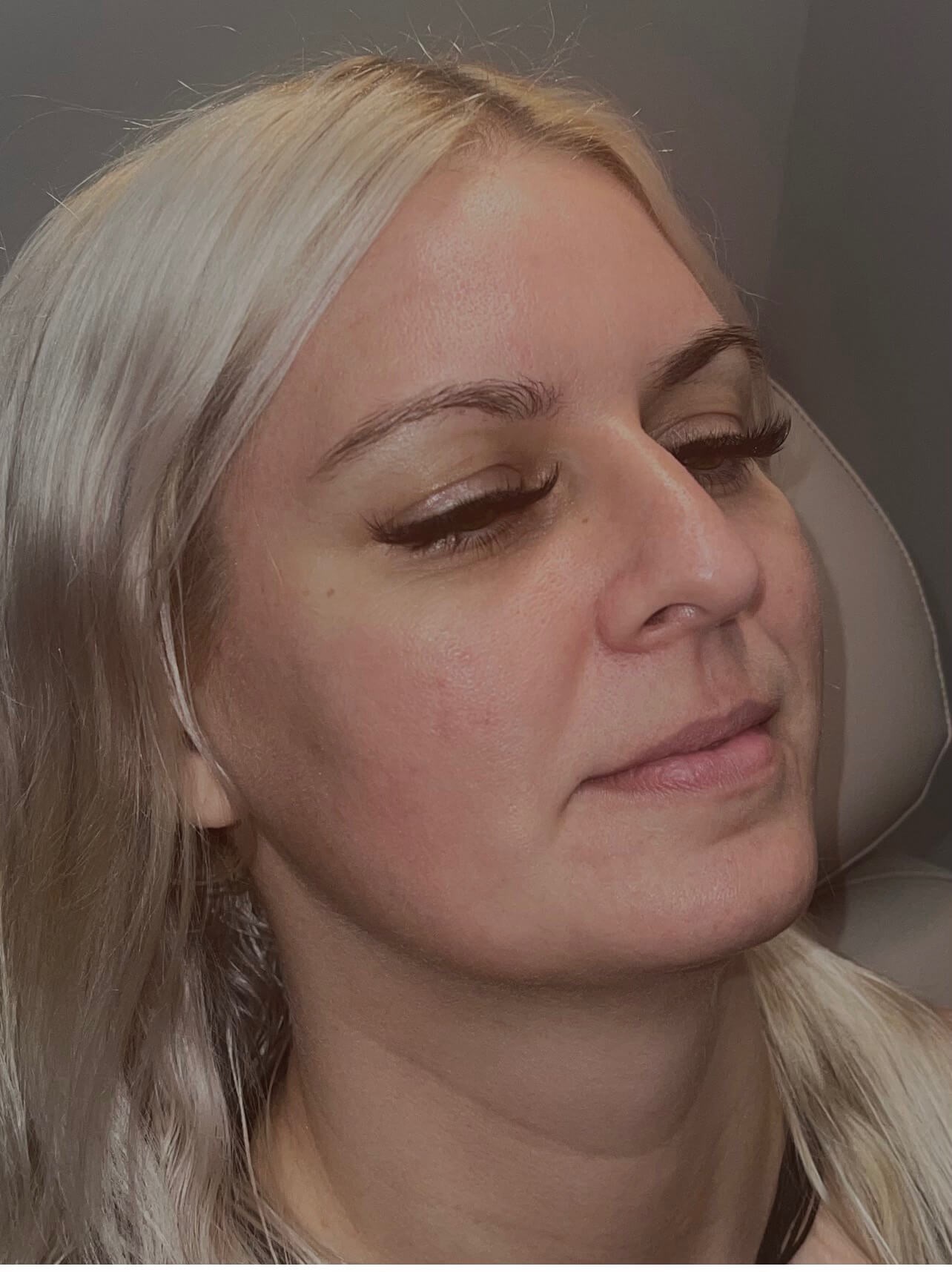 Before Image