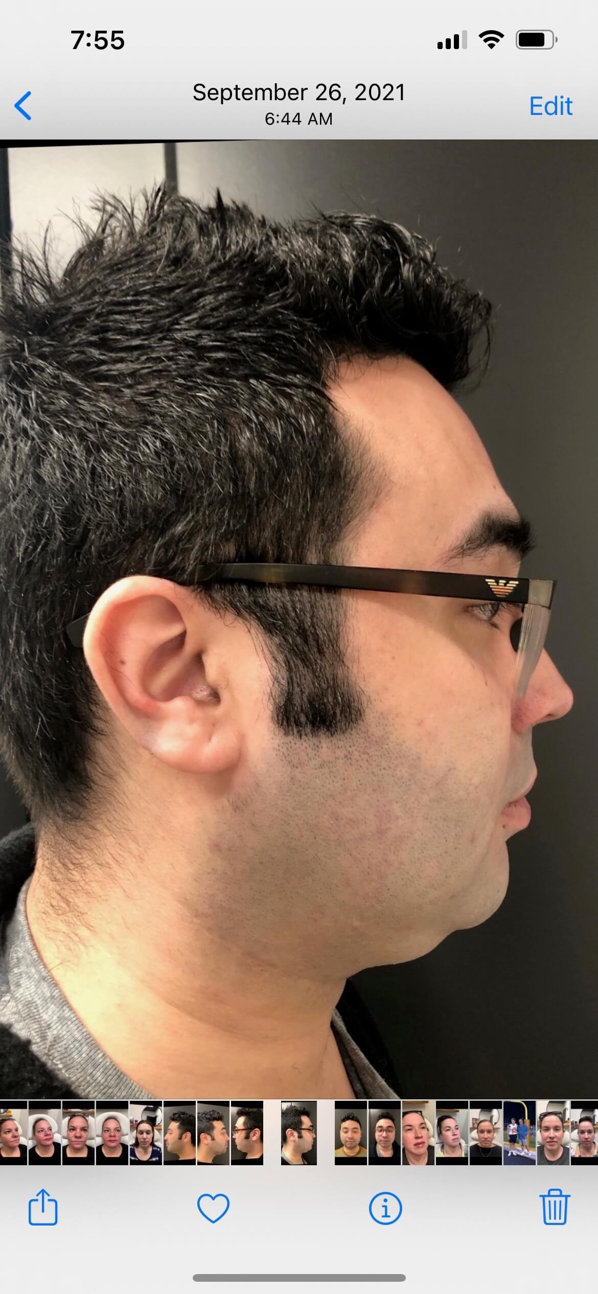 Before Image