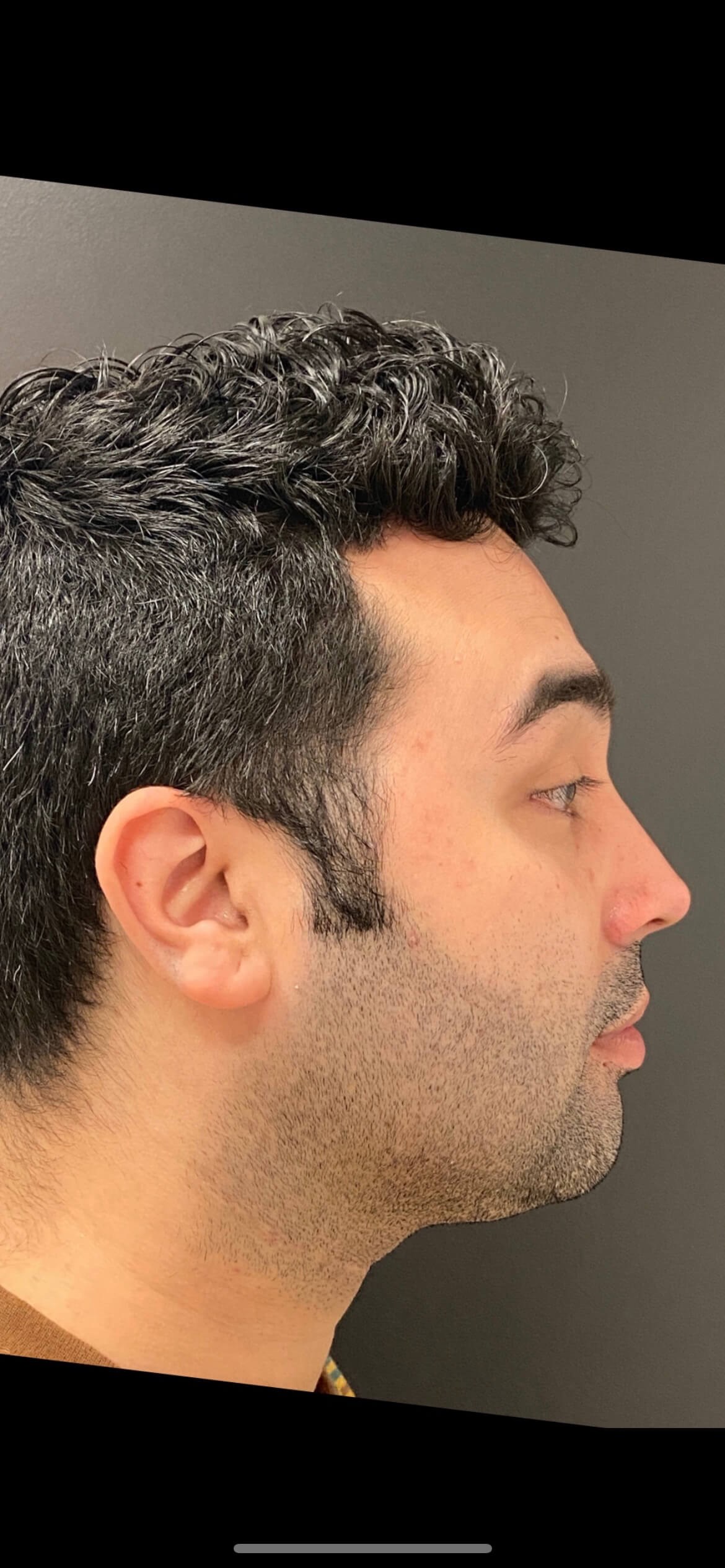 After Image