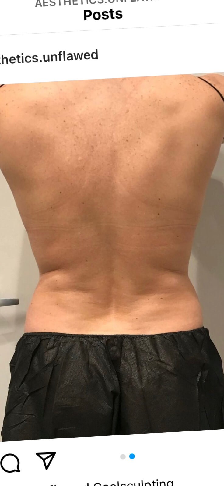 After Image