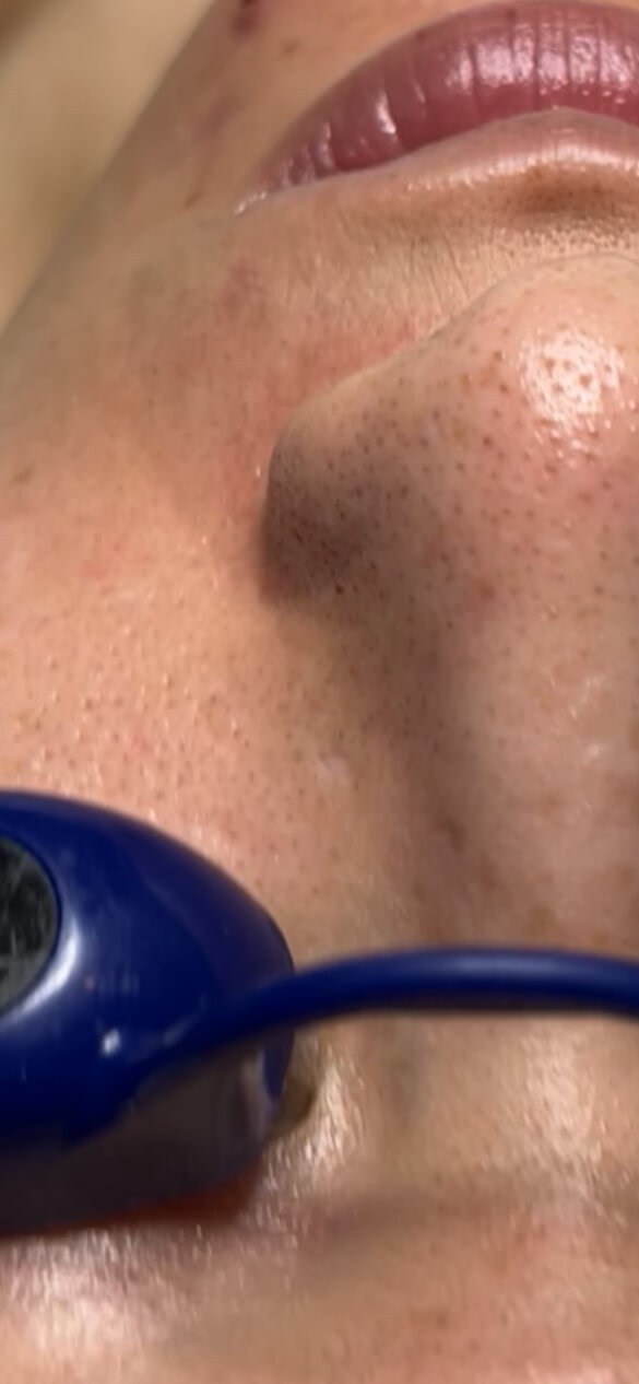 Before Image