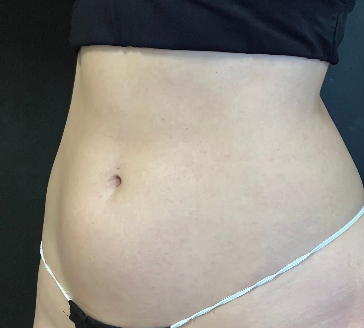 Before Image