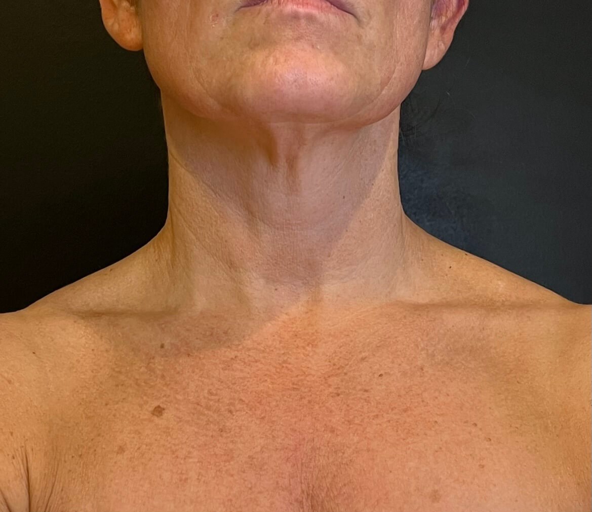 After Image