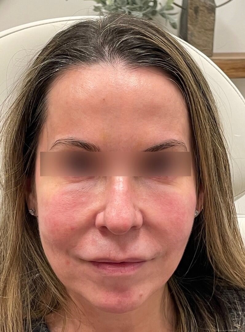 Before Image