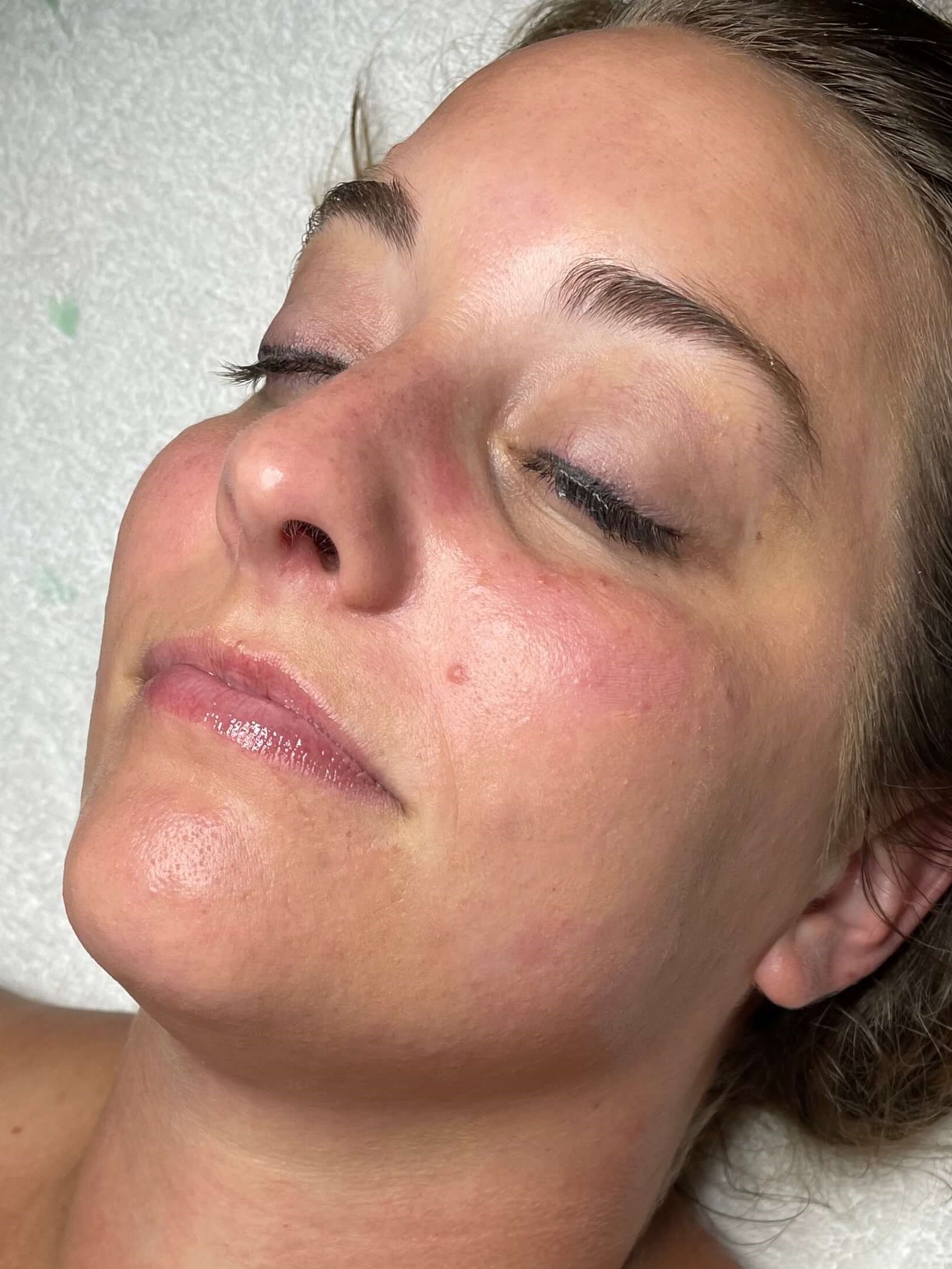 Diamond Glow Facial After